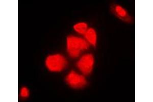 Immunofluorescent analysis of XPO2 staining in NIH3T3 cells. (Exportin 2 抗体  (N-Term))
