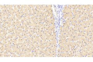 Detection of FKBPL in Human Liver Tissue using Polyclonal Antibody to FK506 Binding Protein Like Protein (FKBPL) (FKBPL 抗体  (AA 1-349))