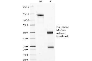 SDS-PAGE Analysis Purified Phosphotyrosine Mouse Monoclonal Antibody (PY20). (Phosphotyrosine 抗体)