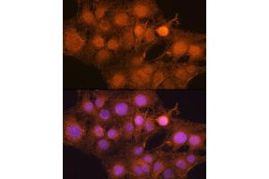 Immunofluorescence analysis of C6 cells using MDM2 antibody (ABIN6133186, ABIN6143671, ABIN6143672 and ABIN6217278) at dilution of 1:100. (MDM2 抗体  (AA 200-430))