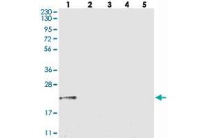 Western blot analysis of Lane 1: RT-4, Lane 2: U-251 MG, Lane 3: Human Plasma, Lane 4: Liver, Lane 5: Tonsil with GGCT polyclonal antibody . (GGCT 抗体)