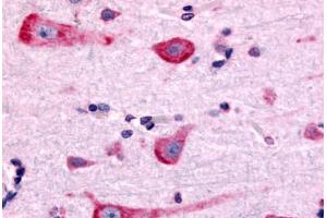 Anti-DRD2 antibody  ABIN1048503 IHC staining of human brain, neurons and glia.