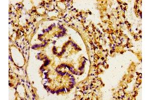 Immunohistochemistry of paraffin-embedded human lung tissue using ABIN7167915 at dilution of 1:100 (ARHGAP1 抗体  (AA 216-308))