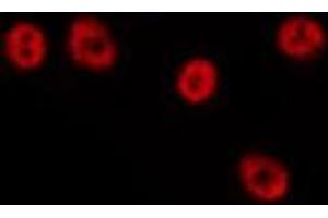ABIN6275692 staining HepG2 by IF/ICC. (ZNF460 抗体  (C-Term))
