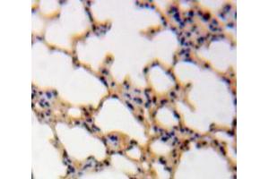 IHC-P analysis of Lung tissue, with DAB staining. (Calmodulin 1 抗体  (AA 2-149))