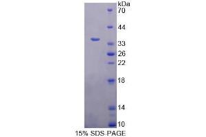 SDS-PAGE (SDS) image for Kell Blood Group, Metallo-Endopeptidase (KEL) (AA 439-713) protein (His tag) (ABIN6238790)