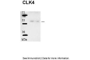 Sample type: human microvascular endothelial cells (25ug)Primary Dilution: 1:1000Secondary Antibody: Goat anti-Rabbit-HRPSecondary Dilution: 1:5000Image Submitted by: Andreas Eisenreich Charite Universitatsmedizin Berlin (CLK4 抗体  (N-Term))