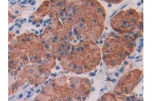 DAB staining on IHC-P; Samples: Human Stomach Tissue (IRAK1 抗体  (AA 212-440))