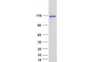 Validation with Western Blot