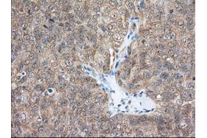 Immunohistochemical staining of paraffin-embedded Human Kidney tissue using anti-ACAT2 mouse monoclonal antibody. (ACAT2 抗体)