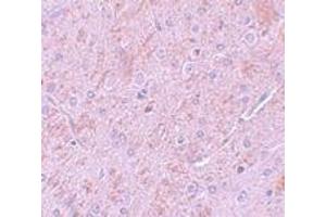 Immunohistochemistry (IHC) image for anti-Protein Inhibitor of Activated STAT, 2 (PIAS2) (N-Term) antibody (ABIN1031511) (PIAS2 抗体  (N-Term))