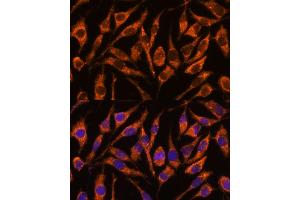 Immunofluorescence analysis of L929 cells using SNX15 antibody  at dilution of 1:100. (SNX15 抗体  (AA 1-342))