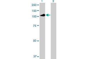 Western Blot analysis of IL12RB2 expression in transfected 293T cell line by IL12RB2 MaxPab polyclonal antibody. (IL12RB2 抗体  (AA 1-862))