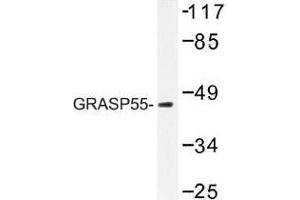Image no. 1 for anti-Golgi Reassembly Stacking Protein 2, 55kDa (GORASP2) antibody (ABIN317911) (GORASP2 抗体)
