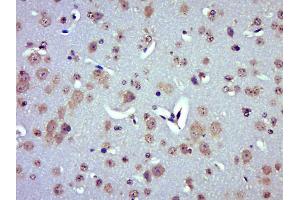 Paraformaldehyde-fixed, paraffin embedded Mouse brain Antigen retrieval by boiling in sodium citrate buffer (pH6. (UCP2 抗体  (AA 201-309))