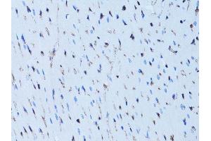 Immunohistochemistry (Paraffin-embedded Sections) (IHC (p)) image for anti-Fatty Acid Binding Protein 4, Adipocyte (FABP4) (AA 1-132) antibody (ABIN3020736)
