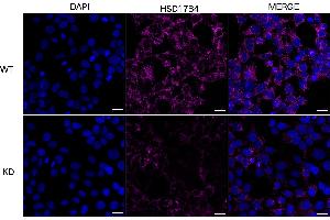 anti-Hydroxysteroid (17-Beta) Dehydrogenase 4 (HSD17B4) antibody
