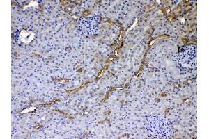 IHC analysis of GALE using anti-GALE antibody . (GALE 抗体  (AA 1-340))