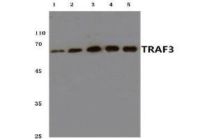 Western blot analysis of TRAF3 antibody at 1/500 dilution. (TRAF3 抗体)