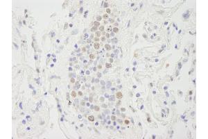 Immunohistochemistry (IHC) image for anti-Suppressor of Ty 6 Homolog (SUPT6H) (AA 425-475) antibody (ABIN7448820) (Spt6 抗体  (AA 425-475))
