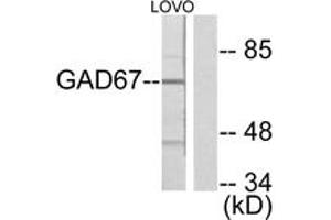 Western blot analysis of extracts from LOVO cells, using GAD1 Antibody. (GAD 抗体  (AA 471-520))