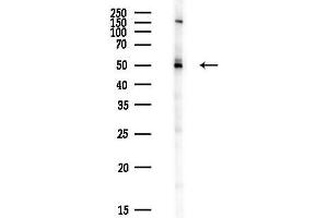 anti-Cold Shock Domain Protein A (CSDA) antibody
