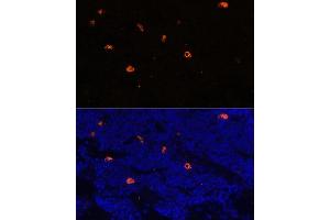 Immunofluorescence analysis of rat bone marrow using CAMP antibody (ABIN7266146) at dilution of 1:100. (Cathelicidin 抗体  (AA 31-170))