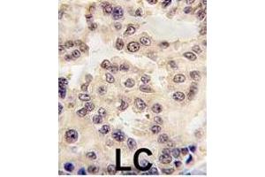 Immunohistochemistry (Paraffin-embedded Sections) (IHC (p)) image for anti-Engrailed Homeobox 1 (EN1) (AA 1-30), (N-Term) antibody (ABIN391430)