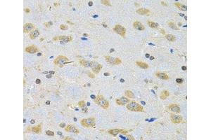 Immunohistochemistry of paraffin-embedded Rat brain using BNIP1 Polyclonal Antibody at dilution of 1:100 (40x lens). (BNIP1 抗体)