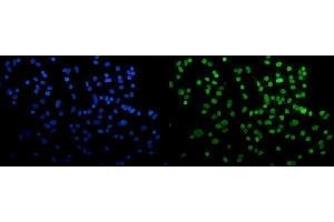 IF analysis of HP1 alpha/CBX5 using anti-HP1 alpha/CBX5 antibody (ABIN7599057).