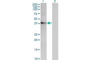 Western Blot analysis of ACOT7 expression in transfected 293T cell line by ACOT7 monoclonal antibody (M02), clone 1E7.