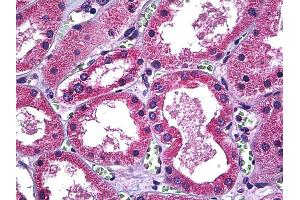 Immunohistochemistry (IHC) image for anti-Solute Carrier Family 11 (Proton-Coupled Divalent Metal Ion Transporters), Member 2 (SLC11A2) (AA 1-66) antibody (ABIN626125)
