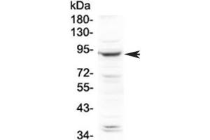 Western blot testing of human HeLa cell lysate with PLA2G6 antibody at 0. (PLA2G6 抗体  (AA 715-802))