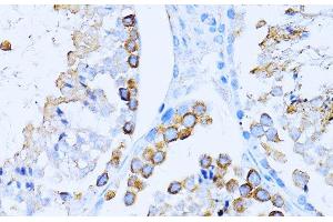 Immunohistochemistry of paraffin-embedded Mouse testis using CD63 Polyclonal Antibody at dilution of 1:100 (40x lens). (CD63 抗体)