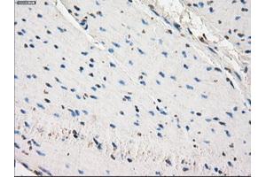 Immunohistochemical staining of paraffin-embedded prostate tissue using anti-SLC2A6mouse monoclonal antibody.