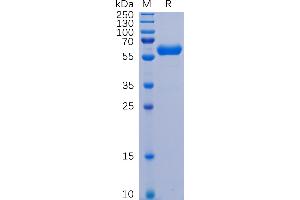 SARS-CoV-2 (2019-nCoV) S protein RBD, hFc Tag on SDS-PAGE under reducing condition.
