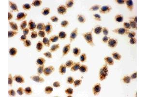 IHC analysis of Cytochrome C using anti-Cytochrome C antibody (ABIN3042783).