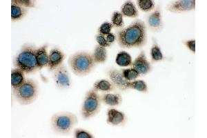 Immunohistochemistry (IHC) image for anti-Chaperonin Containing TCP1, Subunit 4 (Delta) (CCT4) (AA 452-539) antibody (ABIN4886514)