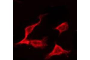 ABIN6275167 staining Hela by IF/ICC. (ERAS 抗体  (C-Term))