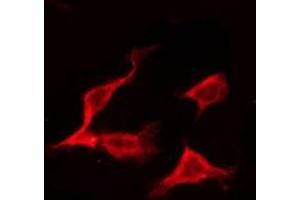 ABIN6275167 staining Hela by IF/ICC. (ERAS 抗体  (C-Term))