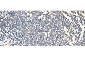 Immunohistochemistry of paraffin-embedded Human tonsil tissue using UBASH3A Polyclonal Antibody at dilution of 1:50(x200) (UBASH3A 抗体)
