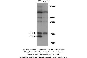 Image no. 1 for anti-Microtubule-Associated Protein 1 Light Chain 3 alpha (MAP1LC3A) (AA 50-150) antibody (ABIN363516)