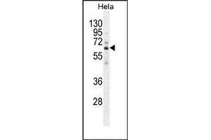 Western blot analysis of HYAL2 Antibody (C-term) in Hela cell line lysates (35ug/lane). (HYAL2 抗体  (C-Term))