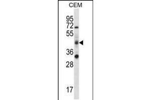 Western blot analysis in CEM cell line lysates (35ug/lane). (RBM42 抗体  (C-Term))