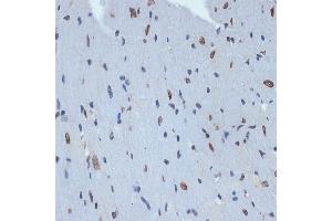 Immunohistochemistry of paraffin-embedded mouse heart using SUN2 Rabbit mAb (ABIN7270135) at dilution of 1:100 (40x lens). (SUN2 抗体)