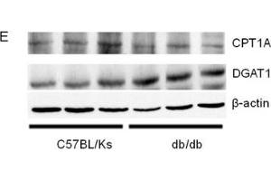 miR-30c-5p expression and triglyceride accumulation in db/db mice(A) Relative expression of miR-30c-5p among different organs. (DGAT1 抗体  (AA 200-300))