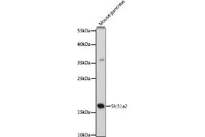 Western blot analysis of extracts of mouse pancreas, using Slc31a2 antibody (ABIN7270450) at 1:500 dilution. (SLC31A2 抗体  (AA 1-100))