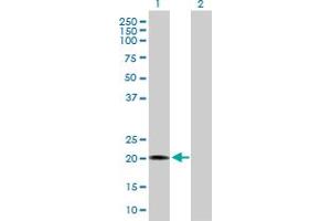 Western Blot analysis of RBBP9 expression in transfected 293T cell line by RBBP9 MaxPab polyclonal antibody. (RBBP9 抗体  (AA 1-186))