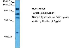 Host: Mouse Target Name: EPHA4 Sample Tissue: Mouse Brain Antibody Dilution: 1ug/ml (EPH Receptor A4 抗体  (C-Term))