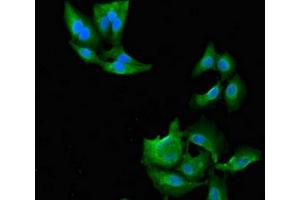 Immunofluorescent analysis of Hela cells using ABIN7144675 at dilution of 1:100 and Alexa Fluor 488-congugated AffiniPure Goat Anti-Rabbit IgG(H+L) (NAT1 抗体  (AA 1-288))